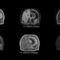 medizinische Software4D MR-RTPhilips Healthcare