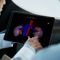 medizinische SoftwareIntuitive Intuitive Surgical