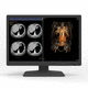 Diagnose-Monitor / für Radiologie / 30