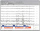 Software für EMG / für Tierarztpraxis / Analyse