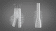 Gefäßprothese / Aorta abdominalis / synthetisch