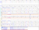 Software für DNA-Sequenzierung / Labor / Analyse / automatisiert