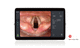 Videoprozessor für Endoskopie / mit Videomonitor / Full-HD-Bildgebung