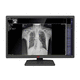 medizinisch Monitor / Diagnose / für medizinische Bildgebung / für Radiologie
