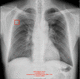 Visualisierungssoftware / Diagnose / Computertomographie / Gehirn