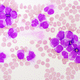Testkit für AML / für myeloproliferative Neoplasien / Onkologie / für Präzisionsmedizin