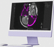 medizinische Software / Projektentwicklung / Umform / Planung