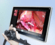 Videorekorder mit DICOM - Konversionsdateien / Diagnose / mit Touchscreen / 4K