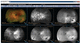 Software für Ophthalmologie / für Krankenhaus / Management / Diagnose