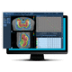 Behandlungsplanungssoftware / für Radiologie / Planung für Strahlenchirurgie / für Tablet-PC