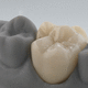 Zahnmedizinisches Material / Zirkonoxid / für Dentalinlays / für Veneere / für Dentalonlays