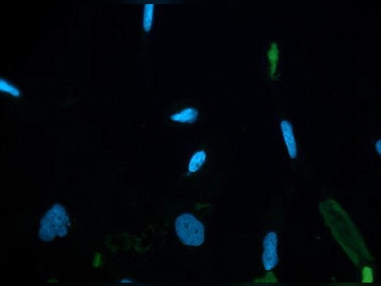 Nervenzelle befleckt durch DAPI