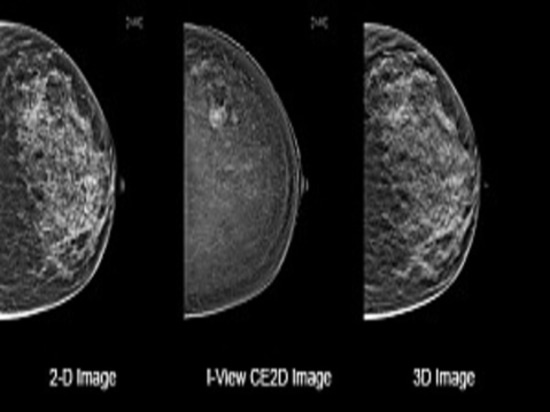 Das 3D-Zukunft der Mammographie