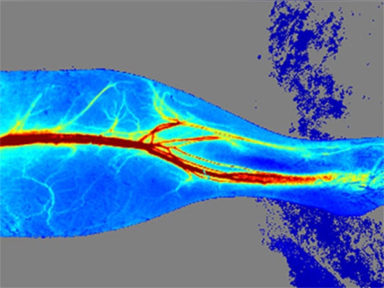 Neues Produkt| RFLSI ZW Laser-Speckle-Kontrast-Bildgebungssystem – ein unvergleichliches Bildgebungserlebnis