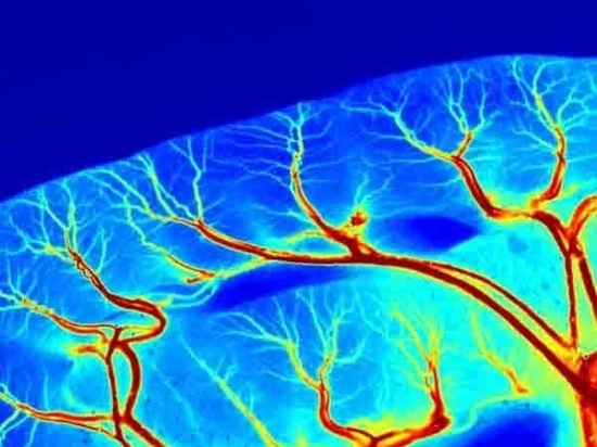 Ausführliche Einführung des RFLSI ZW Laser Speckle Contrast Imaging Systems