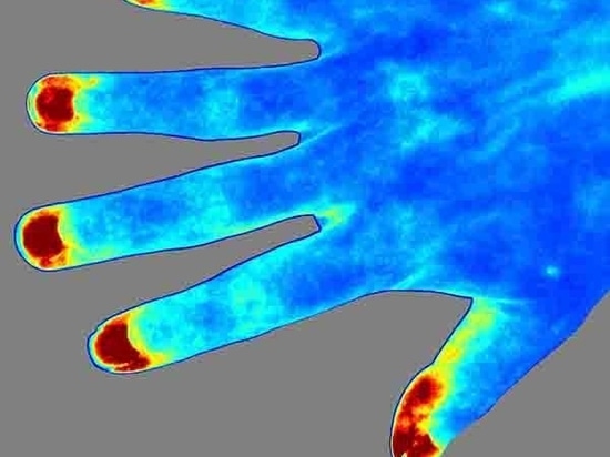 Ausführliche Einführung des RFLSI ZW Laser Speckle Contrast Imaging Systems