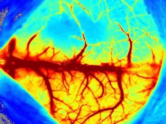 Ausführliche Einführung des RFLSI ZW Laser Speckle Contrast Imaging Systems