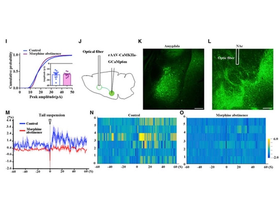 Anwendung der Faserphotometrie bei der Untersuchung neurologischer Erkrankungen