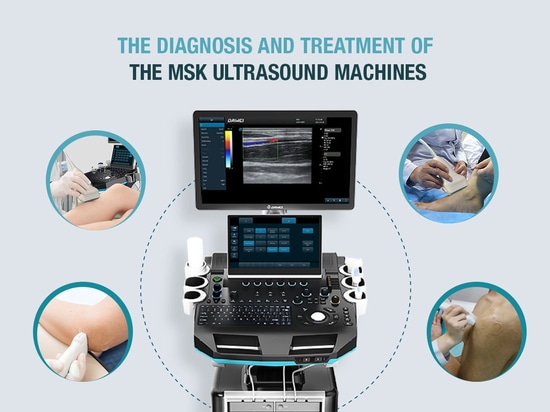 die Diagnose und Behandlung der MSK-Ultraschallgeräte