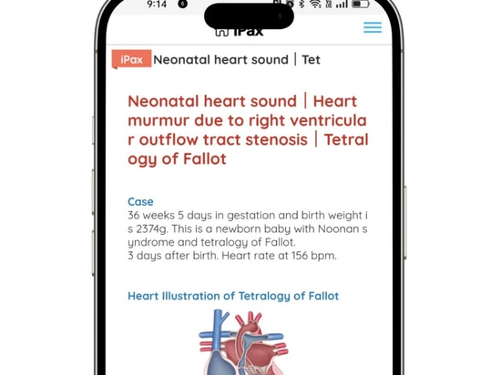 Fallot-Tetralogie