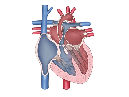 Fallot-Tetralogie