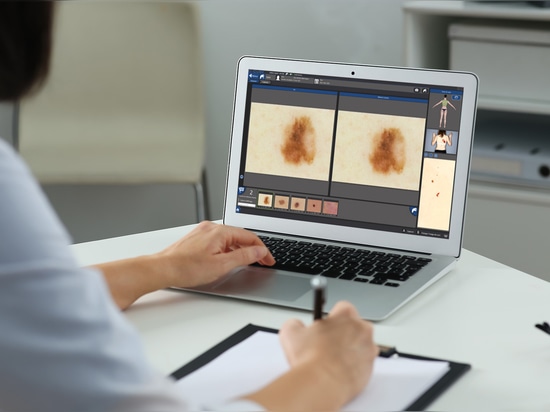 Bieten Sie Ihren Patienten eine außergewöhnliche dermatologische Betreuung mit Bodymapper E4