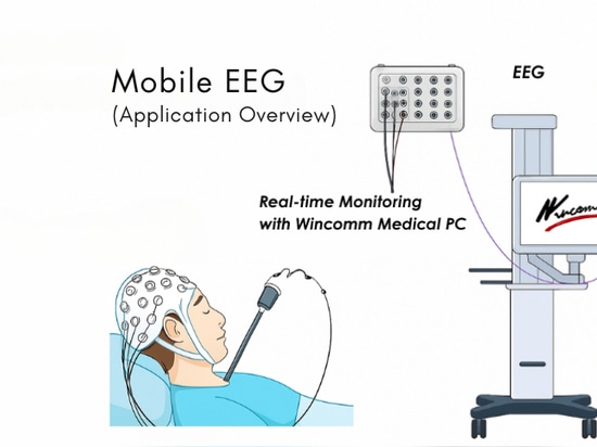 Mobile EEG-Überwachung auf der Intensivstation mit Wincomm WMP-22P | Lüfterloser Medical PC
