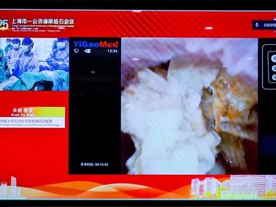 Live-Operation, durchgeführt von Xiao Yu