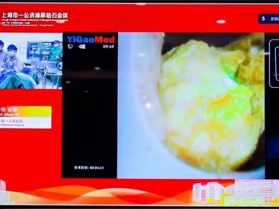 Live-Operation durchgeführt von Yi Shao