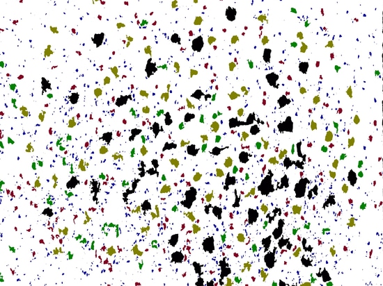 Talg-Analyse