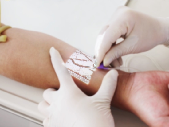 Wie Projektion-Venenfinder in der modernen Gesundheitsversorgung funktionieren