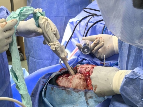 NPUS-01: Das tragbare Ultraschallgerät für die Neurochirurgie