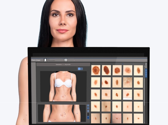 Reduzieren Sie die Wartezeiten mit dem BodyMapper E4