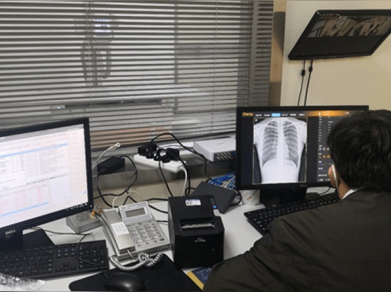 Das Sir Run Run Shaw Hospital, das der Zhejiang University School of Medicine angegliedert ist, hat das zweisäulige DR der Mednova Staray-Serie eingeführt.