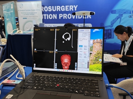 HUIDAMED AACNS 2026 in Manila – Innovation in der Neurochirurgie vorantreiben