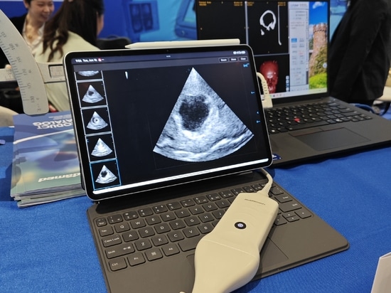 HUIDAMED AACNS 2026 in Manila – Innovation in der Neurochirurgie vorantreiben