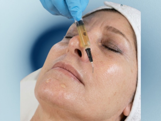 REVYPEEL – Das Hybrid-Peeling