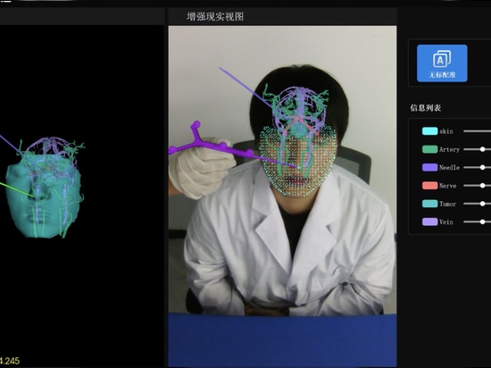 Ruitong SE – 3D-Echtzeit-Tracking ohne Marker