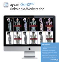 aycan OsiriX PRO Onkologie-Workstation - 1