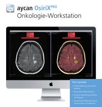 aycan OsiriXPRO Onkologie-Workstation - 1