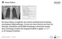 Verbesserungen in  aycan aycan OsiriX PRO Version 3.0 - 5