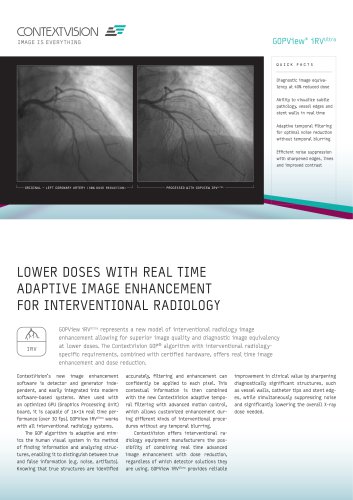 GOPView iRVUltra