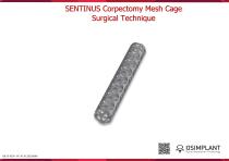 Sentinus Corpectomy Cage Surgical Technique