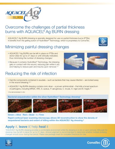 Overcome the challenges of partial thickness burns with AQUACEL&reg;Ag BURN dressing