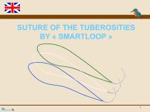 SMARTLOOP