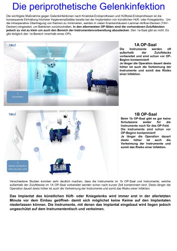 Erweiterung der Schutzzone im OP