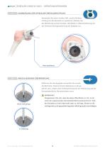 EPISEALER® KNEE-12