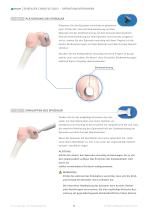 EPISEALER® KNEE-13