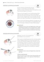 EPISEALER ® TALUS-6
