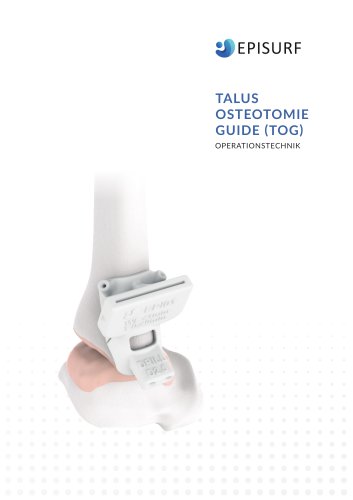 TALUS OSTEOTOMY